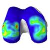 Image of knee joint simulation by Ahmet Erdemir